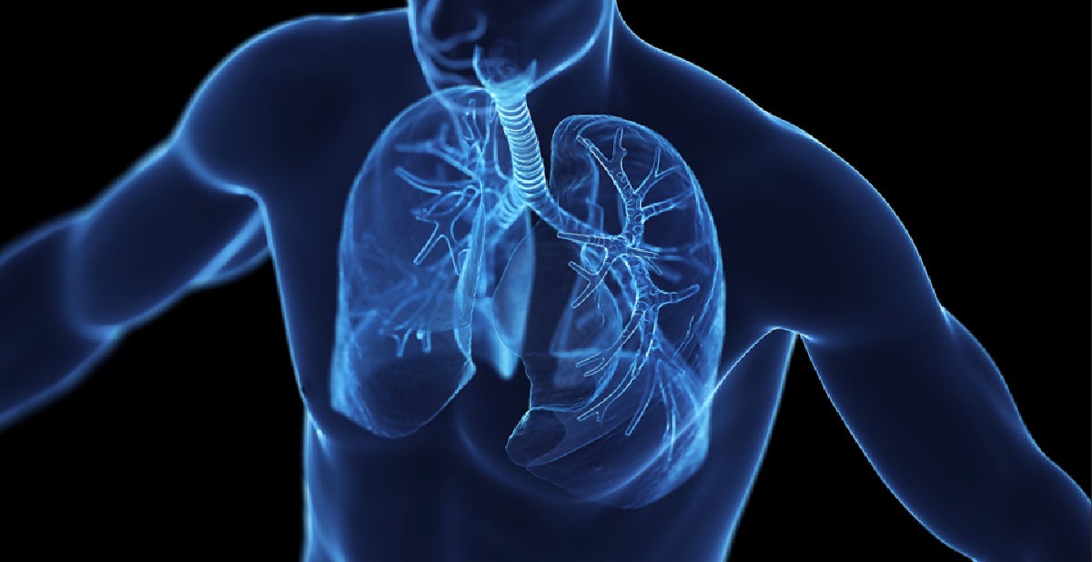 Understanding Asthma